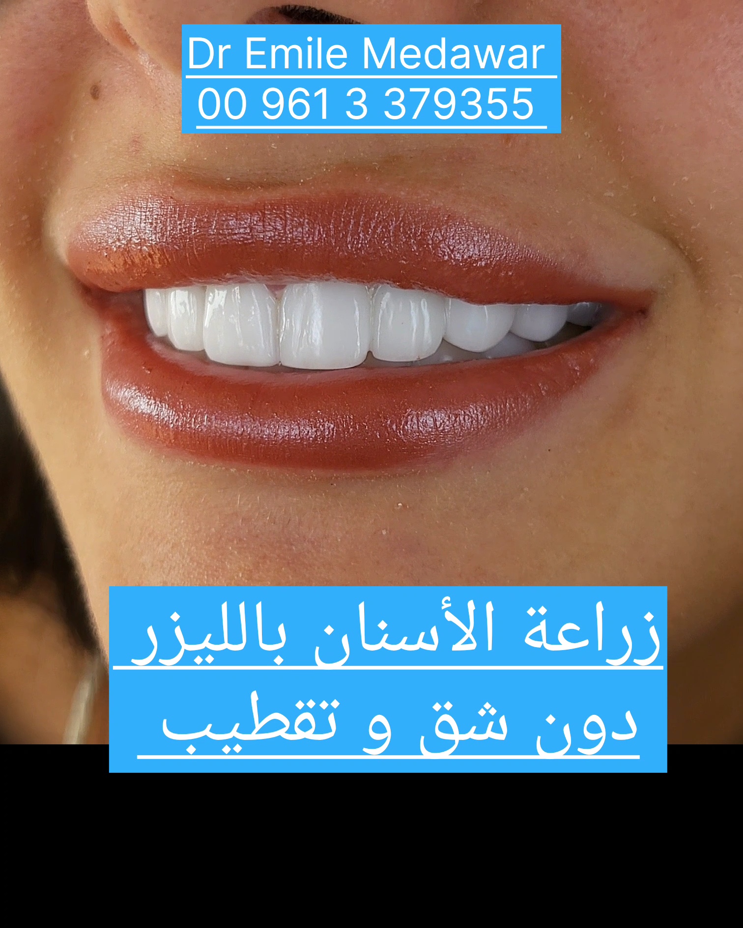 best dentist  in Lebanon 
Beirut