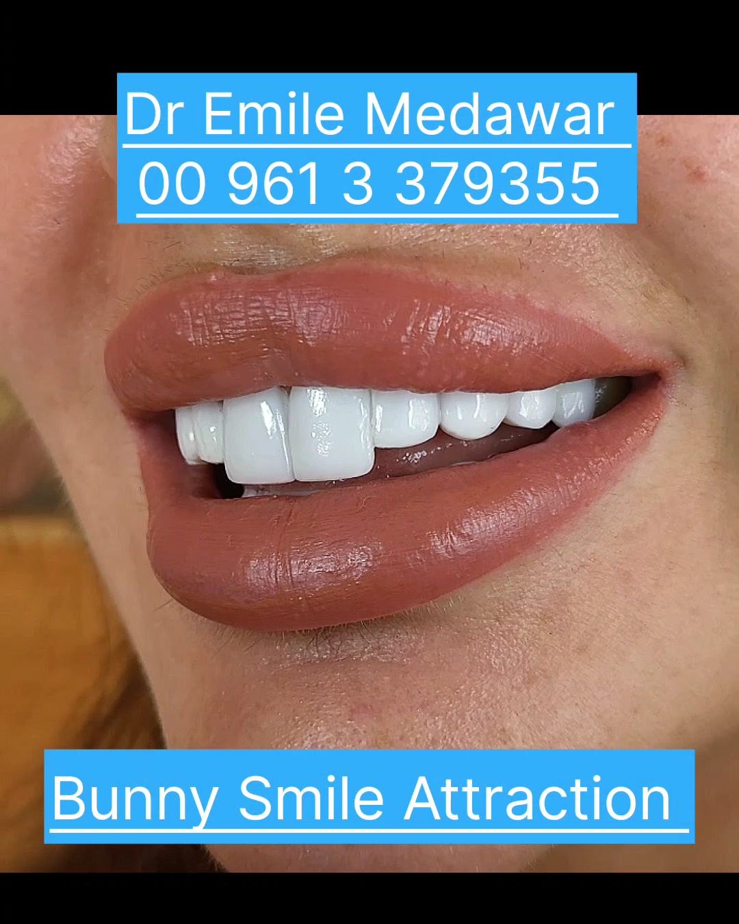 best dentist in Beirut Lebanon